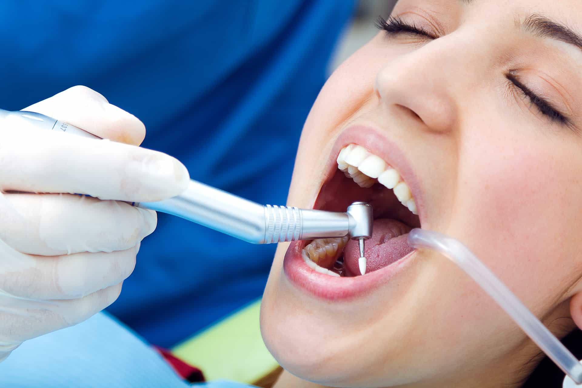 Preventative Dentistry